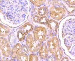 Nav1.7 Mouse anti-Human, Clone: 1D6, Novus Biologicals 100 &mu;l; Unconjugated:Antibodies,